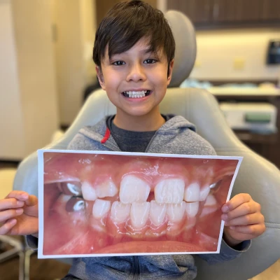 Kids Braces Before & After 1